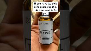 TCA CROSS is the best treatment for your ice pick acne scars acne acnescars tcapeel skincare [upl. by Bank]