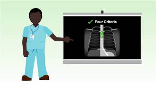 Nasogastric tube misplacement continuing risk of death and severe harm [upl. by Lunette]