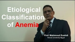 Etiological Classification of Anemia Lecture2021 [upl. by Onra483]