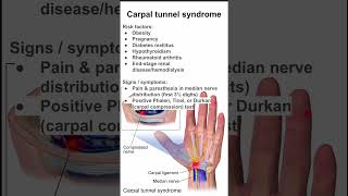 Carpal tunnel syndrome [upl. by Enigroeg]