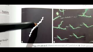 Syphilis Treponema Pallidum  Laboratory Diagnosis  NonTreponemal VDRLRPR and Treponemal test [upl. by Rolyak]