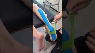 Use kinesiology tape to stabilize the ankle Achilles tendon to reduce running injuries [upl. by Eardnoed864]