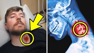 MrBeasts Life Changing Surgery sad [upl. by Kurtis]