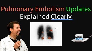 Pulmonary Embolism  Thromboembolism Updates Explained Clearly [upl. by Smoot]