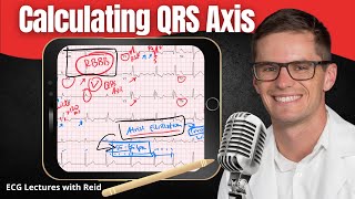 How to Calculate QRS Axis 3 Methods EKG  ECG Lecture [upl. by Yedrahs]