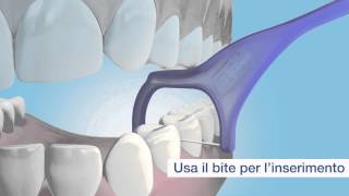 TePe Mini Flosser™ una facile e comoda pulizia interdentale [upl. by Atinehs]