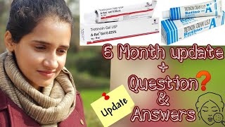 Tretinoin cream 005 results after 2 year and answers of all your questions  best anti aging [upl. by Aivata865]