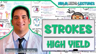 Ischemic and Hemorrhagic Strokes  High Yield [upl. by Ahseuqram212]