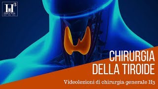 Chirurgia della tiroide [upl. by Dlanor]