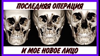 Последняя операция и новое лицо Распаковка покупок и подарков брендов Lookfantastic Missha Iherb [upl. by Adnilav912]