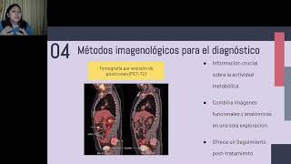 Lesiones Quísticas Pancreáticas [upl. by Resay317]