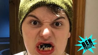 Teeth whitening disaster PRANK [upl. by Enened]