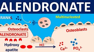 Alendronate for osteoporosis  Mechanism side effects precautions amp uses [upl. by Rick]