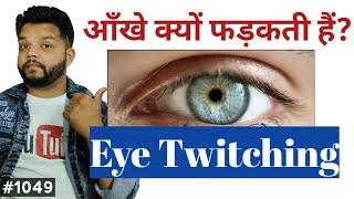 आंख क्यों फडकती है 🔥 Eye Twitching Causes In Hindi  Gyanear [upl. by Atiuqrehs]