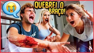 QUEBREI O MEU BRAÇO FEIO  TROLLANDO NAMORADA  REZENDE EVIL [upl. by Noonberg654]