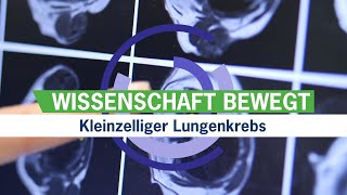 Kleinzelliger Lungenkrebs Zwei neue Ansatzpunkte für Therapien  Wissenschaftsnachrichtenvideo [upl. by Svensen]