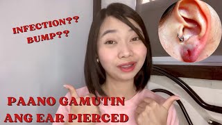 Paano gamutin ang ear pierced infection or bump  How to heal your infected ear pierced [upl. by Nazay]