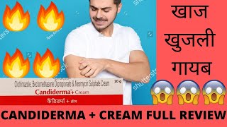 Candiderma plus Cream Full Review Effect and side Effect Best for Fungal infection खुजली गायब 🔥😃😃 [upl. by Dalenna]