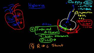 Hypoxia Shunts and Ventilation Perfusion Mismatch [upl. by Ardine]