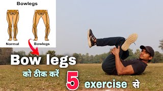 Bow legs correction exercises । Bow legs kaise thik karen । Army nagar 🇮🇳 [upl. by Letsyrk949]