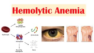 Preventing Hemolysis in the Blood Samples You Draw [upl. by Oal]