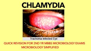 Chlamydia  Microbiology  Bacteriology Trachoma Quick revision for 2nd yr MBBS microbiology exams [upl. by Sesom532]