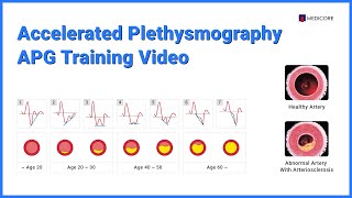 Accelerated Plethysmography  APG Training Video [upl. by Ahseal]