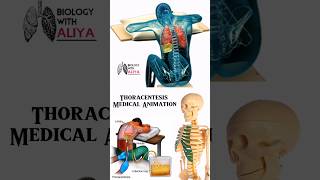 Thoracentesis Medical Animation  biology With Aliya medical animation 3d short [upl. by Larisa450]