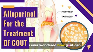 ALLOPURINOL Tablets ip 100mg AND GOUT Treatment [upl. by Rep614]