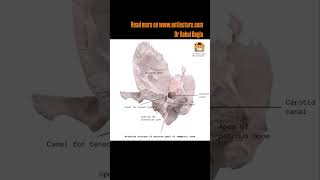 Anatomy of Temporal Bone  Link in Description  Dr Rahul Bagla Teaching ENT [upl. by Greenfield]