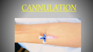 How to pass IV cannula  intravenous Cannula kaisey lagatey hain cannula cannulainsertionforyou [upl. by Idurt62]