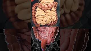 Constipation 3d Animation Anatomy Presentation anatomy viralvideo shorts meded [upl. by Culhert]