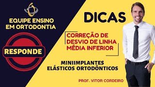 Correção de desvio de Linha Média inferior por meio de Miniimplantes e Elásticos Ortodônticos [upl. by Carmencita]