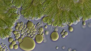 Botryococcus braunii a mostly carbon net neutral biofuel DIC microscopy [upl. by Soiritos956]