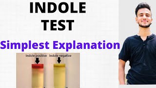 INDOLE TEST IN MICROBIOLOGY Bacterial Identification Test [upl. by Ansilma]