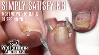 Simply Satisfying Pedicure Cleaning Most Viewed Toenails Spring 2019 [upl. by Strawn]