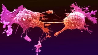 New Cancer Drug Shrinks All Tumors [upl. by Alyakcim]