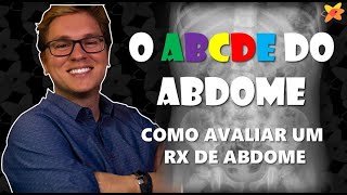 COMO AVALIAR RAIO X ABDOME  O ABCDE DO ABDOME I VOCÊ RADIOLOGISTA [upl. by Dom]