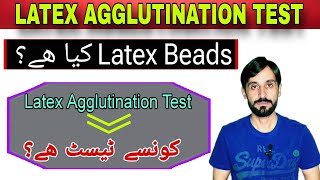 Latex Agglutination Test [upl. by Hanahs]