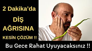 çürük diş ağrısına ne iyi gelir  Diş Ağrısına Kesin Çözüm [upl. by Adneram]