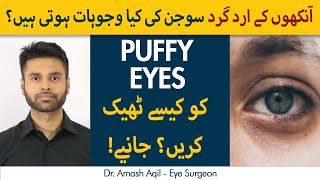 Ankhon ki Sujan Ka Ilaj  Puffiness In Eyes  Causes and Treatment in UrduHindi [upl. by Kiyohara396]