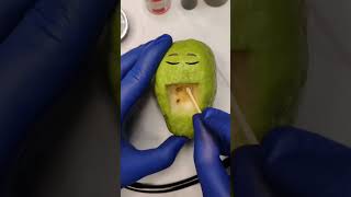 🗣️Worms in the Guava needs surgery remove the worms good luck shorts fruitsurgery doodles 😀 [upl. by Omle885]