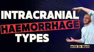 Intracranial HaemorrhagesHaematomas [upl. by Newman]