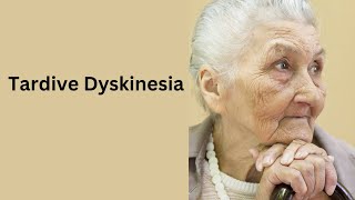 Tardive Dyskinesia Caused by Antipsychotic Medication [upl. by Aber]