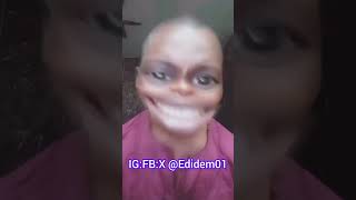 show me way she dey this evening tèéth go surplus edidem01 fyp viral subcribe [upl. by Enoj476]