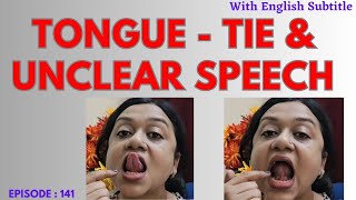 Tongue tie and Speech issuesTongue Tie amp unclear speechAnkyloglossia [upl. by Nylinnej]