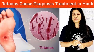 Clostridium Tetani Tetanus  Causes Symptoms Diagnosis Treatment in Hindi  Tetanus Cause Treat [upl. by Atiana]