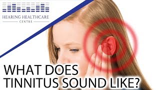 What Does Tinnitus Sound Like [upl. by Vidovic]