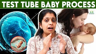 Test Tube Baby Treatment Tamil  Dr Deepthi JammiCwc  IVF procedure  infertility fertility [upl. by Calderon]