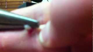 how to remove a wart [upl. by Nannarb]